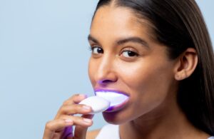 Benefits of GettingmOpalescence Teeth Whitening Treatment in Charlotte