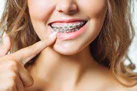 3 reasons to seek orthodontic care for adults